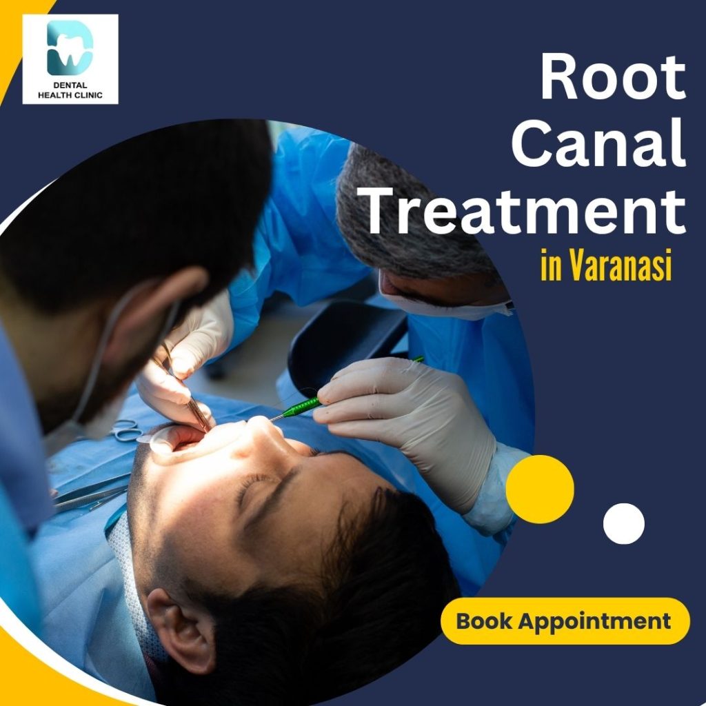 root canal treatment varansi