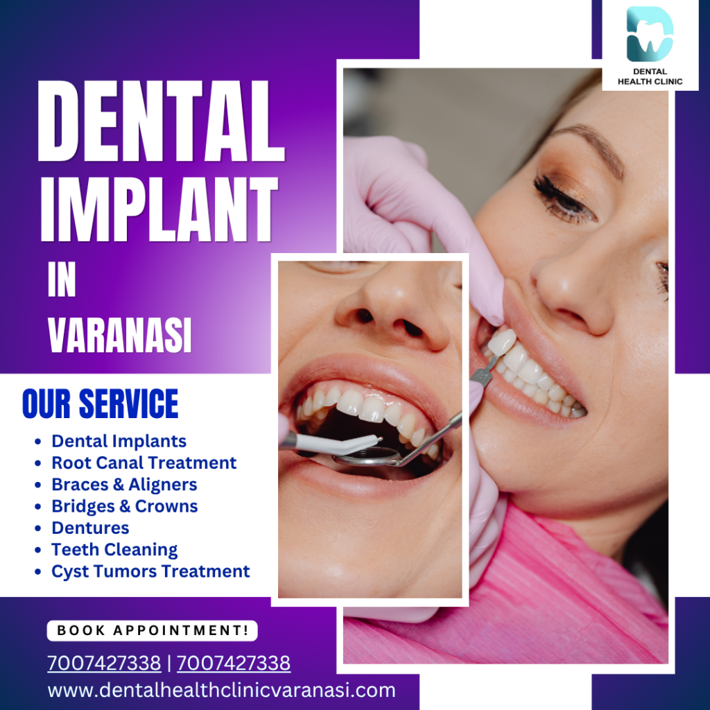 dental implant varanasi